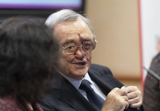 Campanha de arrecadação de fundos lançada para apoiar o avanço espanhol na pesquisa do câncer de pâncreas