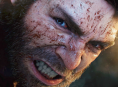 Marvel's Wolverine ator estudou c&atilde;es raivosos para interpretar um Logan mais selvagem