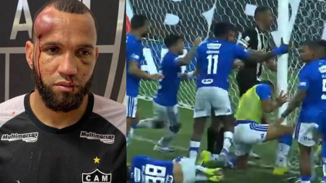 Brutal batalha de campo no Brasil termina com 23 jogadores expulsos e ferimentos graves