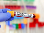 Inglaterra no caminho para se tornar um dos primeiros pa&iacute;ses a eliminar a hepatite C