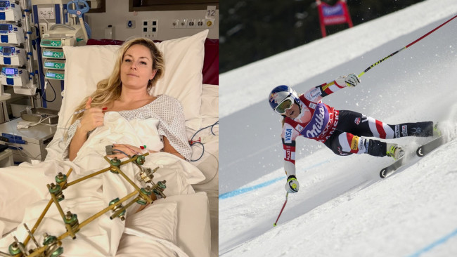 A esquiadora americana Lindsey Vonn passa por uma terceira cirurgia na perna